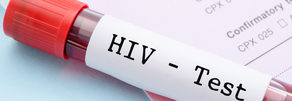 Bei unklarem HIV-Status ist eine PEP nach riskantem Sex zu empfehlen.