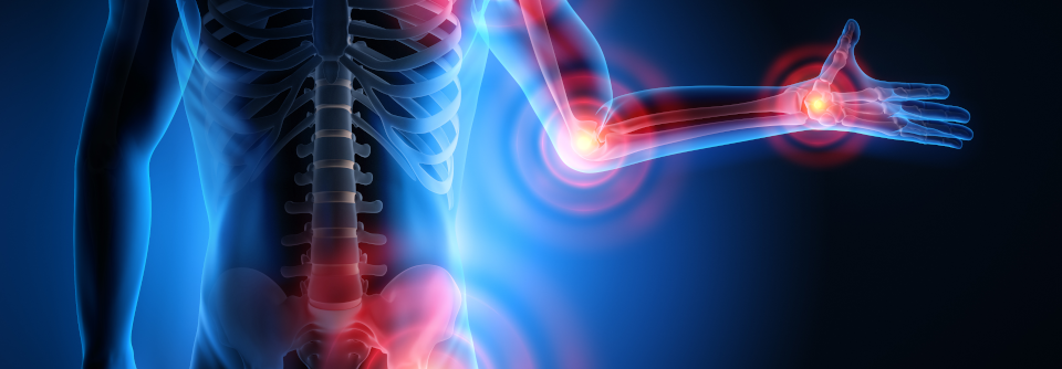 Bei der Multifidusstimulation aktivieren zwei Elektroden die Musculi multifidi der Lendenwirbelsäule, um den Rücken zu stärken.