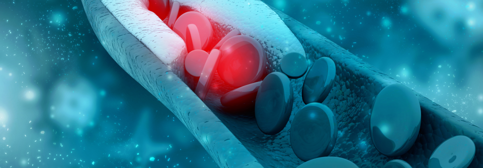 Eine erhöhte LDL-C-Konzentration sollte in der Primär- und Sekundärprävention effektiv und vor allem anhaltend gesenkt werden.