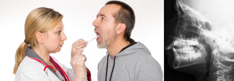 Rechts im Bild: Adenoide Vegetationen bei einem neunjährigen Kind – ohne Symptome gelten sie als nicht behandlungsbedürftig.