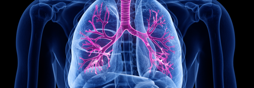 Verglichen wurden COPD-Patienten mit und ohne steroidale Therapiekomponente.
