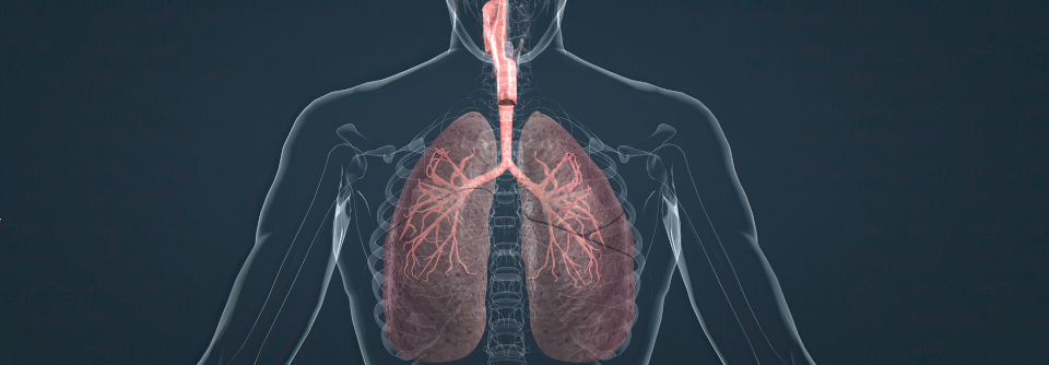 Insgesamt sehen die Forschenden eine Indikation für Mukolytika bei COPD-Exazerbationen.