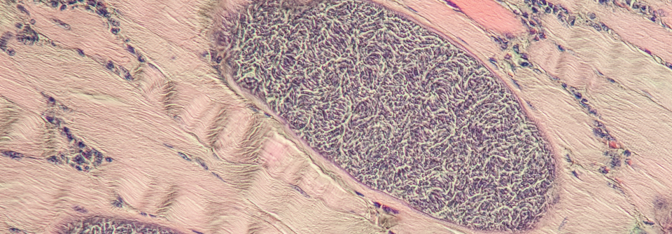 Zwischenwirte für Sarcocystis sind z.B. Schweine oder Rinder. Die Parasiten bilden Zysten in deren Muskulatur.