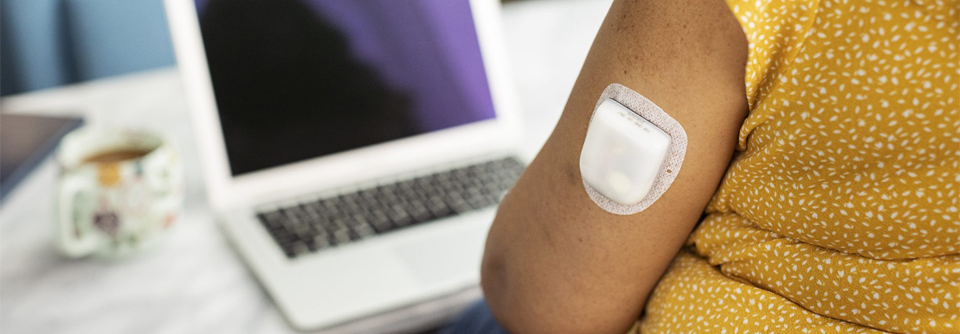 Neues AID-System mit schlauchloser Insulinpumpe Die Insulingabe des neuen AID-Systems Omnipod 5 von Insulet erfolgt über einen schlauchlosen und wasserdichten Pod, der u.a. am Oberarm getragen werden kann.