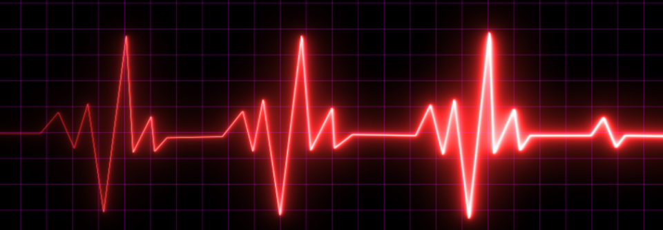 Auffällige Ergebnisse in den Belastungstests konnten nicht nur einen kardiovaskulären, sondern auch den Tod jeglicher Ursache vorhersagen, und zwar unabhängig von pathologischen EKG-Veränderungen.