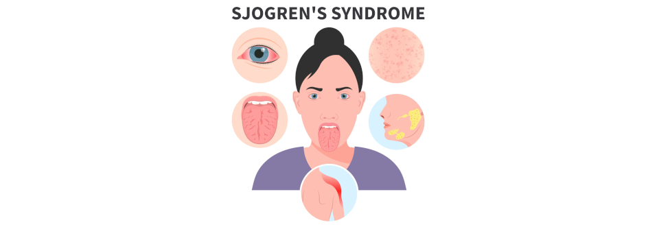 Diejenigen ohne subjektive Xerostomie bzw. Xerophthalmie waren früher als ihre Leidensgenossen mit solchen Symptomen erkrankt.