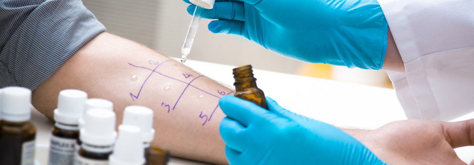 Das ­Aufdecken von allergischen Reaktionen mittels entsprechender Tests kann dabei helfen, eine indizierte Behandlung sicher durchzuführen.