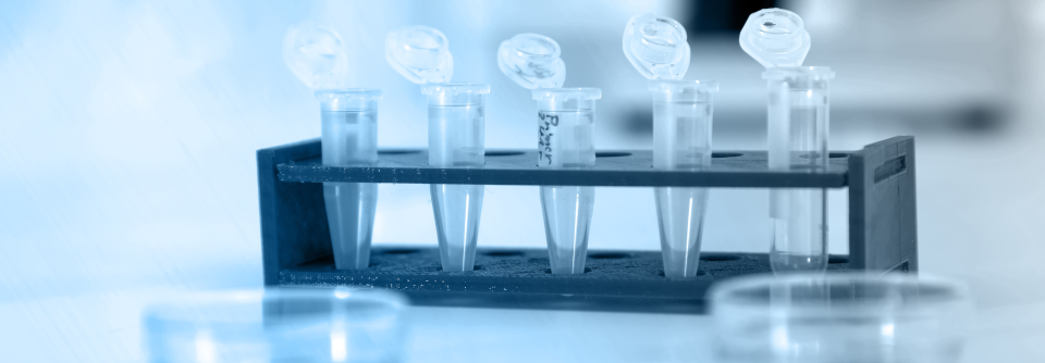 Bluttest detektiert verschiedene Karzinome im Frühstadium Man wollte untersuchen, ob sich Plasmaproteine als Biomarker für bestimmte solide Tumoren nutzen lassen.