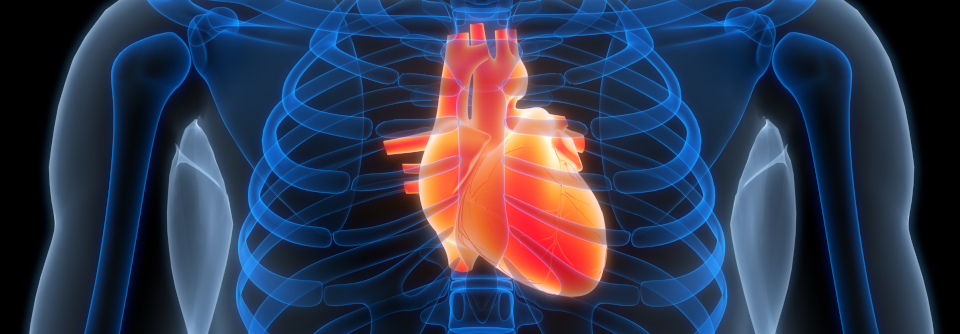 Vor allem bei VHF-Patienten mit Herzinsuffizienz und eingeschränkter Pumpfunktion ist die Katheter­ablation die Therapie der Wahl.
