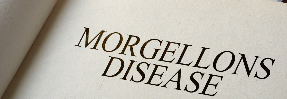 Wissenschaftler aus den Bereichen Dermatologie, Psychiatrie und Infektiologie haben den aktuellen Wissensstand zu Morgellons zusammengefasst. 