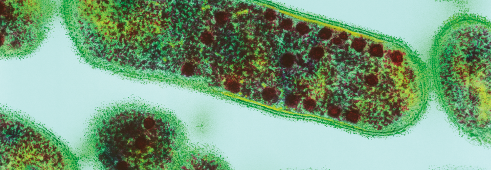 Gardnerella bietet durch sein großes Adhäsionsvermögen am Vaginalepithel die Basis für einen polybakteriellen Biofilm.