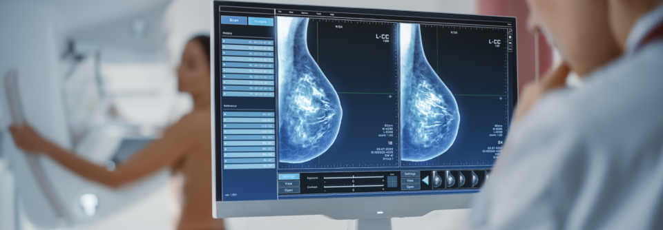 Was sind die Risikofaktoren für Brustkrebs zwischen den Screening-Terminen? Eine Mammografie kann die Erkrankung an und die Sterblichkeit durch ein Mammakarzinom verhindern.