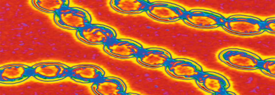 Die kugeligen Streptokokken bilden Ketten (kolorierte Aufnahme einer Transmissionselektronenmikroskopie).