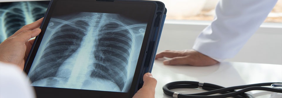 Eine verstärkte Anreicherung des Glukoseanalogons in der semiquantitativen PET/CT-Untersuchung stand über die Zeit sowohl bei aktiven als auch bei ehemaligen Rauchenden mit dem Fortschreiten eines Emphysems in Verbindung.